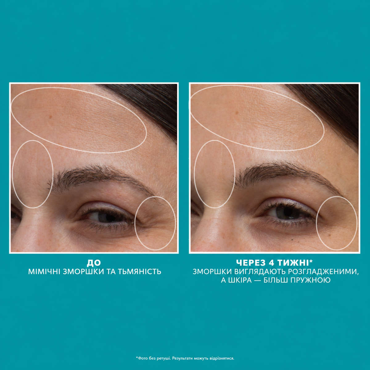 Peptide Skinjection Moisture Infusion Cream - Крем для інтенсивного зволоження та боротьби зі зморшками Peter Thomas Roth