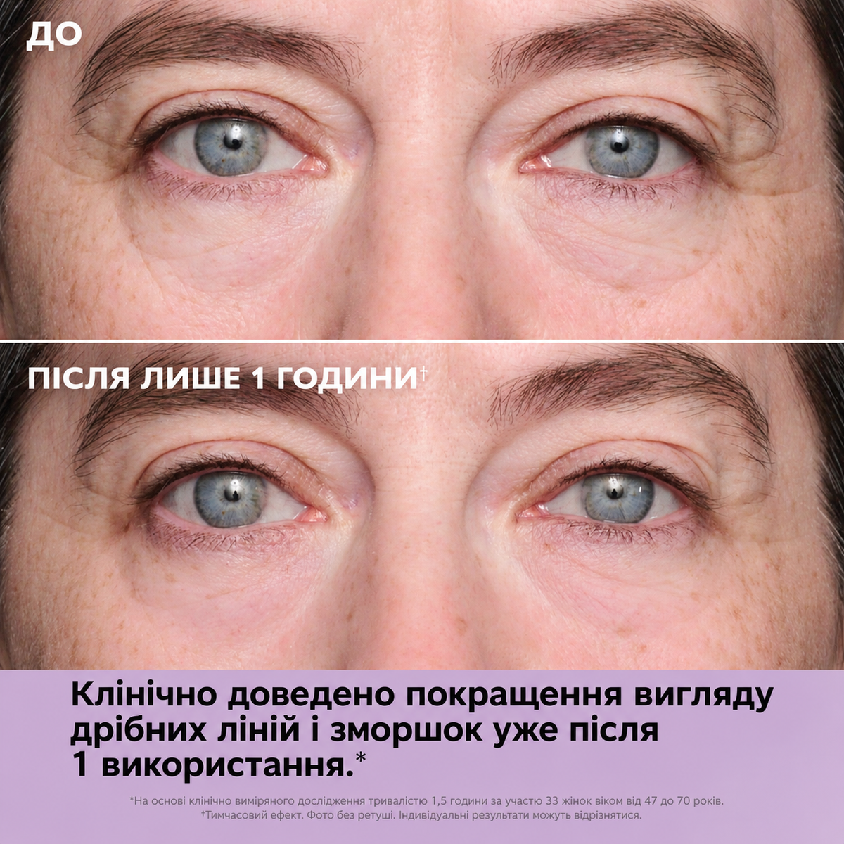 Instant FIRMx® Collagen Infusion Tightening Eye Patches - Підтягуючі патчі для шкіри навколо очей з колагеном Peter Thomas Roth
