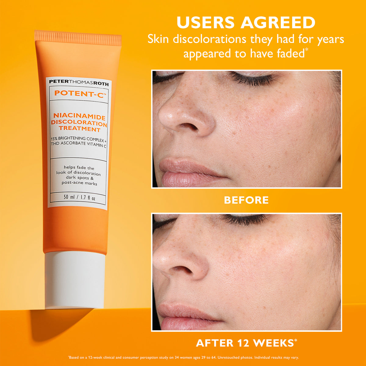 Potent-C Niacinamide Discoloration Treatment - Крем-гель з ніацинамідом та вітаміном С для вирівнювання тону обличчя Peter Thomas Roth